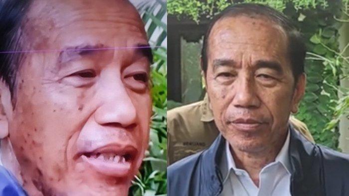 Jokowi Alergi Kulit, Benarkah Terpapar Steven Johnson Syndrom?
