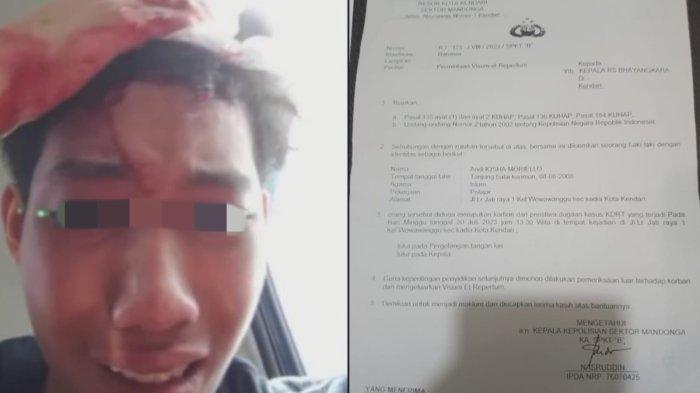 Kronologi Hakim di Kendari Bacok Kepala Anaknya Usai Keluar dari Kantor Polisi, Ngaku Hanya Refleks