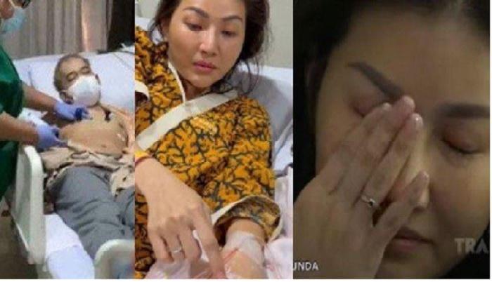 Sempat Dirahasiakan, Ruben Onsu Akhirnya Ungkap Alasan Sembunyikan Sakit Parah Sarwendah