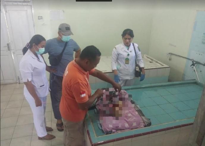 Kondisi-bayi-yang-baru-dilahirkan-18-hari-diduga-dibunuh-ibu-kandungnya1.jpg