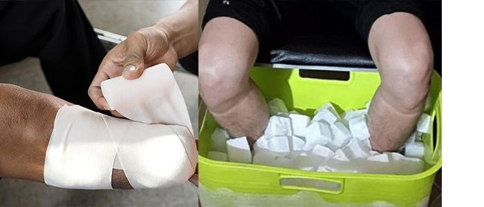 Demi Dapatkan Uang Asuransi Rp 20 Miliar, Mahasiswa Ini Nekat Buat Kakinya Diamputasi, Akhirnya Pilu