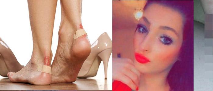 PILU-Wanita-Cantik-Syok-Kakinya-Harus-Diamputasi-Gegara-Lecet-Pakai-SepatuNyesal-Tak-Langsung-Obati.jpg