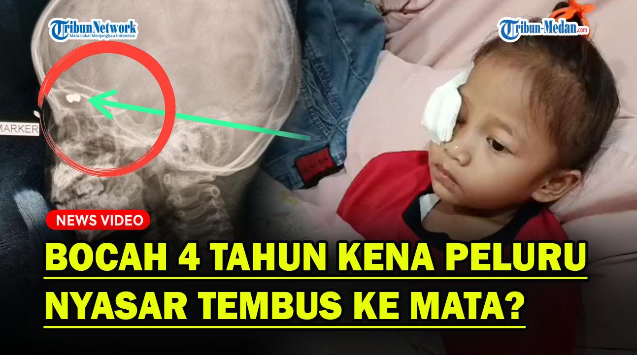 Peluru-nyasar-tembus-ke-mata-bocah-di-Belawan.jpg