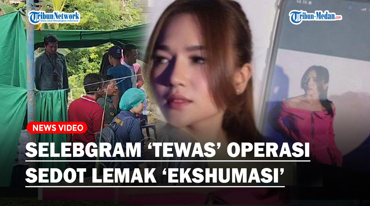 Polisi-Ngaku-Sudah-Dapat-Izin-Keluarga-Ekshumasi-Jasad-Selebgram-yang-Tewas-saat-Operasi-Sedot-Lemak.jpg