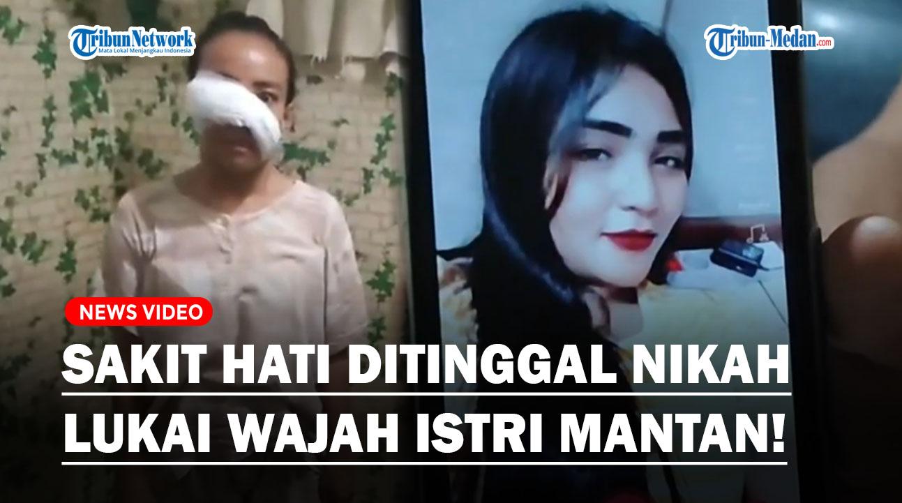 Seorang-perempuan-tega-melukai-wajah-istri-dari-mantan-kekasihnya.jpg