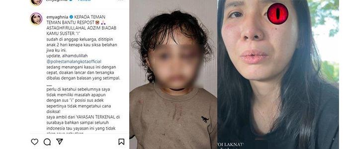 TAMPANG-Suster-I-Pembantu-yang-Aniaya-Anak-Selebgram-Aghnia-hingga-Babak-Belur-Wajah-Disiram-Minyak.jpg