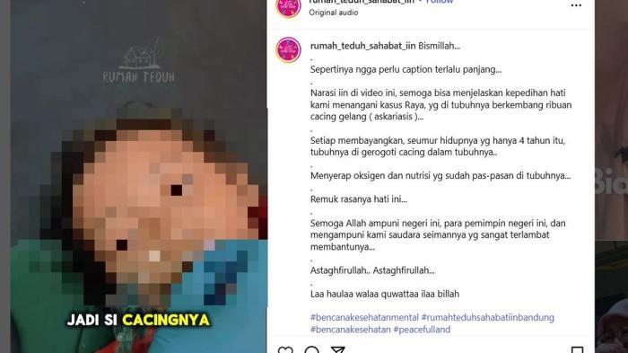 TUBUH-PENUH-CACING-Raya-bocah-tiga-tahun-warga-Kampung-Padangenyang-Desa-Cianaga.jpg