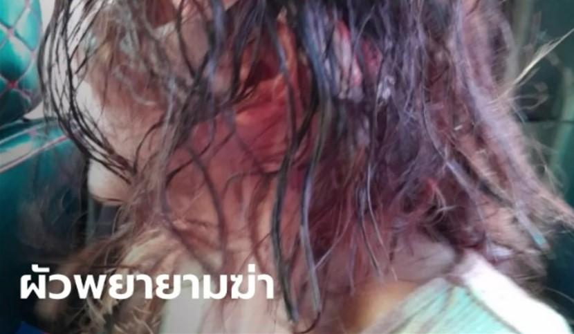 Wanita-nyaris-tewas-diserang-suami-pakai-kapak_berita-viral-internasional_.jpg
