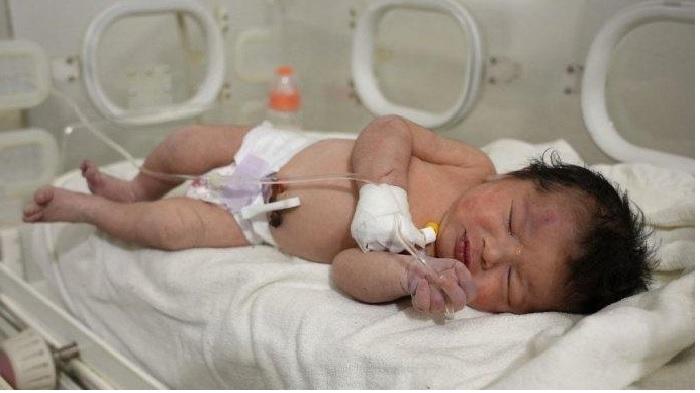 bayi-korban-gempa-turki-tribunmedan.jpg