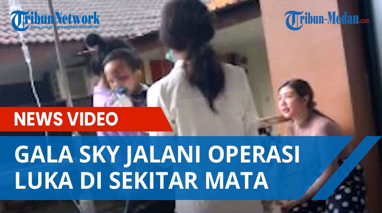 gala-sky-anak-dari-vanessa-angel-dan-bibi-ardiansyah-jalani-operasi-luka-di-bagian-mata-sebelah-kiri.jpg