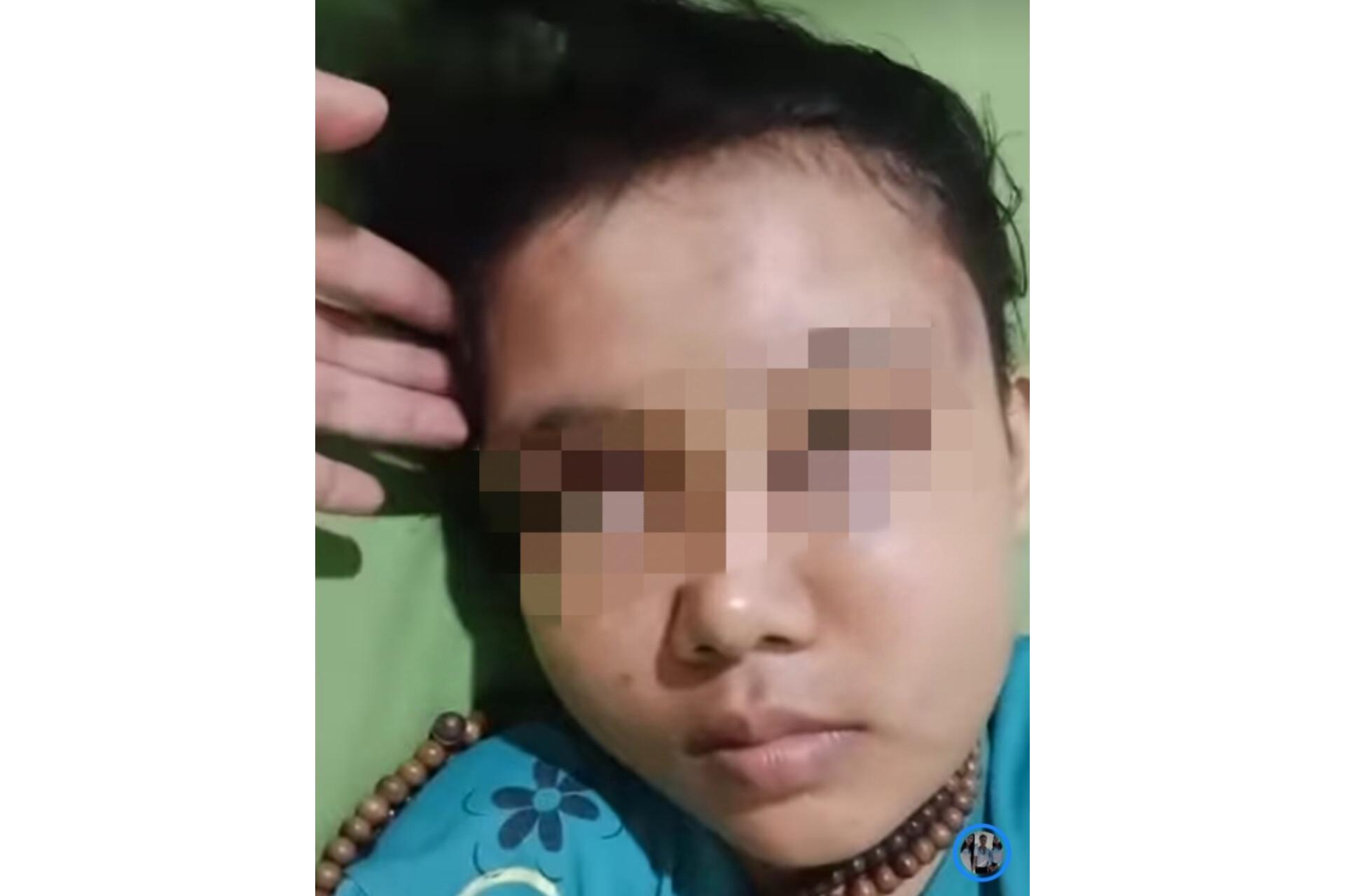 kondisi-wanita-yang-diduga-menjadi-korban-rudapaksa-saar-berada-di-sebuah-klinik.jpg