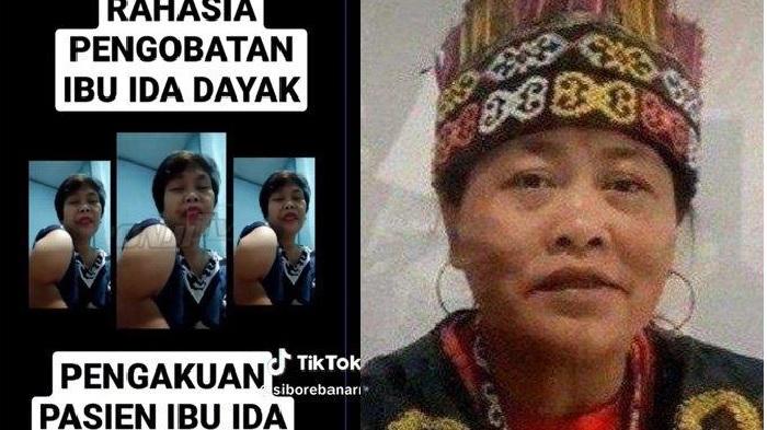 pasien-ida-dayak-tribunmedan.jpg