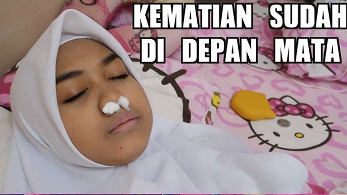 Posting Foto dengan Wajah Pucat Hidung Ditutup Kapas, Ria Ricis Panen Kritikan Dari Netizen