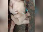 Bayi-Lahir-Dengan-Enak-Kaki.jpg