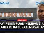 Bayi-kembar-siam-lahir-di-asahan.jpg