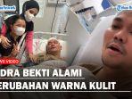 KONDISI-Terbaru-Indra-Bekti-Sudah-Ada-Perubahan-Warna-Kulit-hingga-Lepas-Infus.jpg