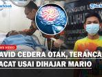 Kondisi-David-Alami-Cidera-Otak-dan-Terancam-Cacat-Usai-Jadi-Korban-Keganasan-Mario.jpg