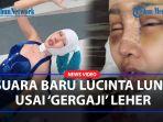 MERDUNYA-Suara-Baru-Lucinta-Luna-Usai-Operasi-Potong-Leher-Bikin-Netizen-Penasaran.jpg