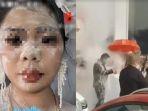 Nikah-Mewah-di-Hotel-Pengantin-Cemong-Dilempari-Tepung-Wajah-Sampai-Memar-Kena-Kardus.jpg