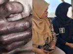 PILU-Gadis-Disabilitas-di-Bandung-Dicabuli-9-Pria-Selama-2-Tahun-Sampai-Hamil-6-Bulan-Pelaku-Masih.jpg