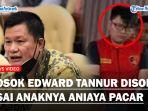 SOSOK-Anggota-DPR-Edward-Tannur-Disorot-Usai-Anaknya-Aniaya-Pacar-Hingga-Disekap-di-Mobil.jpg