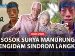 SOSOK-Surya-Manurung-Pria-Pengidap-Sindrom-Langka-yang-Berani-Lamar-Gadis-Canti-Jadi-Istrinya.jpg