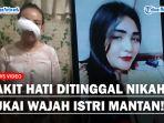 Seorang-perempuan-tega-melukai-wajah-istri-dari-mantan-kekasihnya.jpg