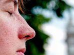 Steven-Johnson-Syndrome-3.jpg