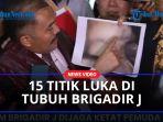 Tak-Cuma-Luka-Tembak-Ini-15-Titik-Luka-di-Tubuh-Brigadir-J-Menurut-Kuasa-Hukum.jpg