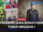 Terdapat-Luka-Serius-Pada-Tubuh-Brigadir-J-Ini-Penjelasan-Polisi-dan-Ahli-Forensik.jpg