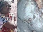 VIRAL-Nenek-81-Tahun-Mengandung-Janin-Selama-56-Tahun-Sampai-Jadi-Batu-Dikira-Cuma-Nyeri-Perut.jpg