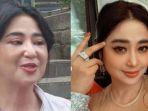Wajah-Dewi-Perssik-Bengkak-Hingga-Penampilannya-Berubah-Sang-Pedangdut-Ungkap-Penyebabnya.jpg
