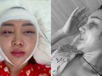 Wajah-Lucinta-Luna-Usai-Operasi-Plastik.jpg