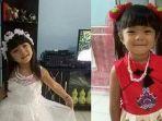 bocah-perempuan-berusia-8-tahun-digigit-anjing-pitbull.jpg