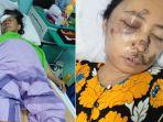 ibu-dan-anak-korban-begal-di-Medan-Jalan-Cemara.jpg
