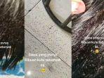viral-penampakan-ribuan-kutu-rambut-di-kepala-seorang-bocah-di-Trenggalek-Jawa-Timur-1.jpg