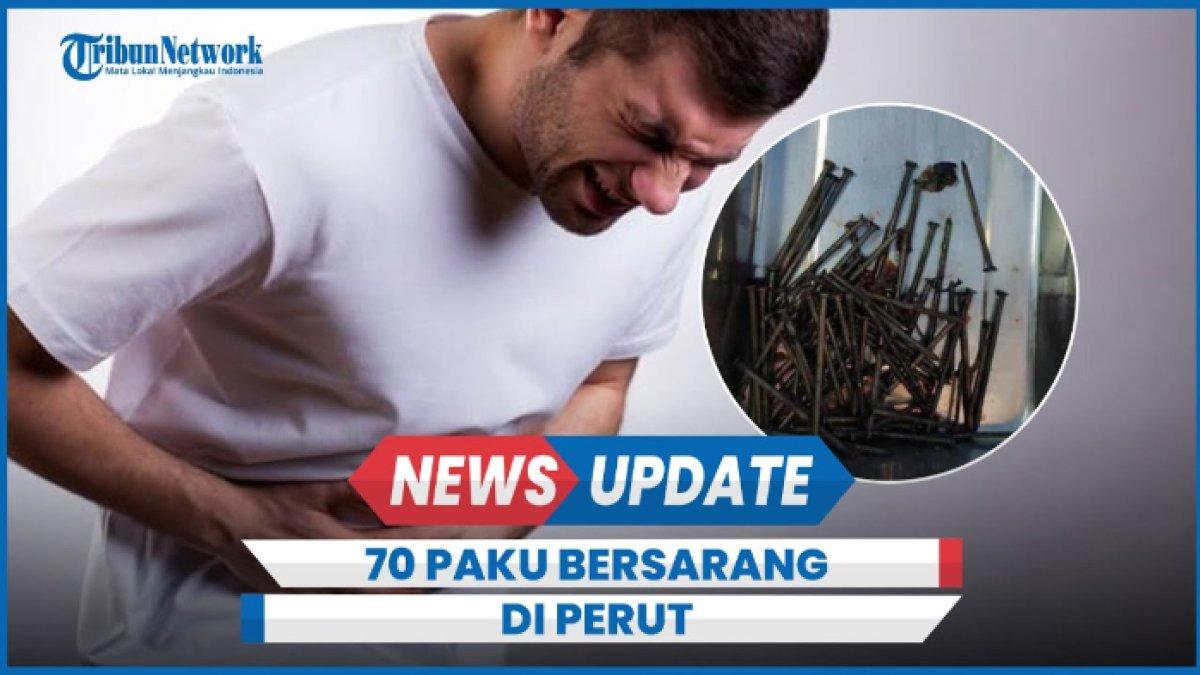 5 Fakta Mencengangkan 70 Paku Bersarang di Perut Pemuda di Indramayu, Jabar: ODGJ & Overdosis Obat