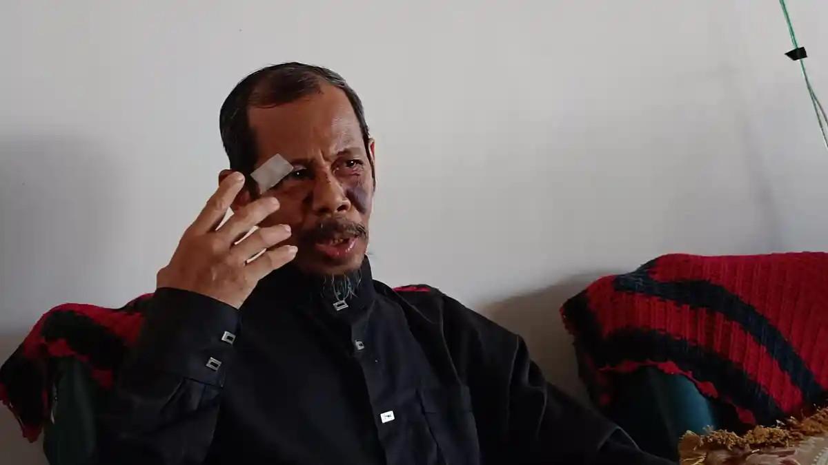 PENGEROYOKAN - Ahmad (62) seorang imam Masjid As Salam, Kelurahan Benteng, Kecamatan Wara Timur, Kota Palopo mengalami penganiyaan yang dilakukan oleh 4 orang setelah menegur anak-anak yang bermain mikrofon masjid.