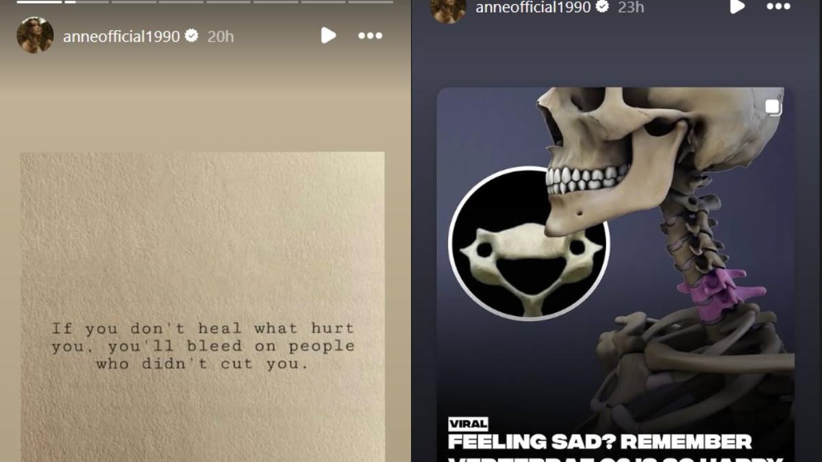UNGGAHAN PUTRI ANNE - Amanda Manopo dikabarkan akan menikah dengan Kenny Austin, Putri Anne unggah ini