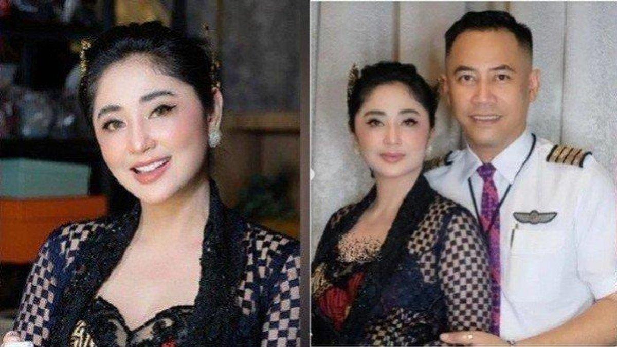 Cerai dari Saipul Jamil & Aldi Taher Tanpa Anak, Ini Bocoran Cara Dewi Perssik Punya Anak dari Rully