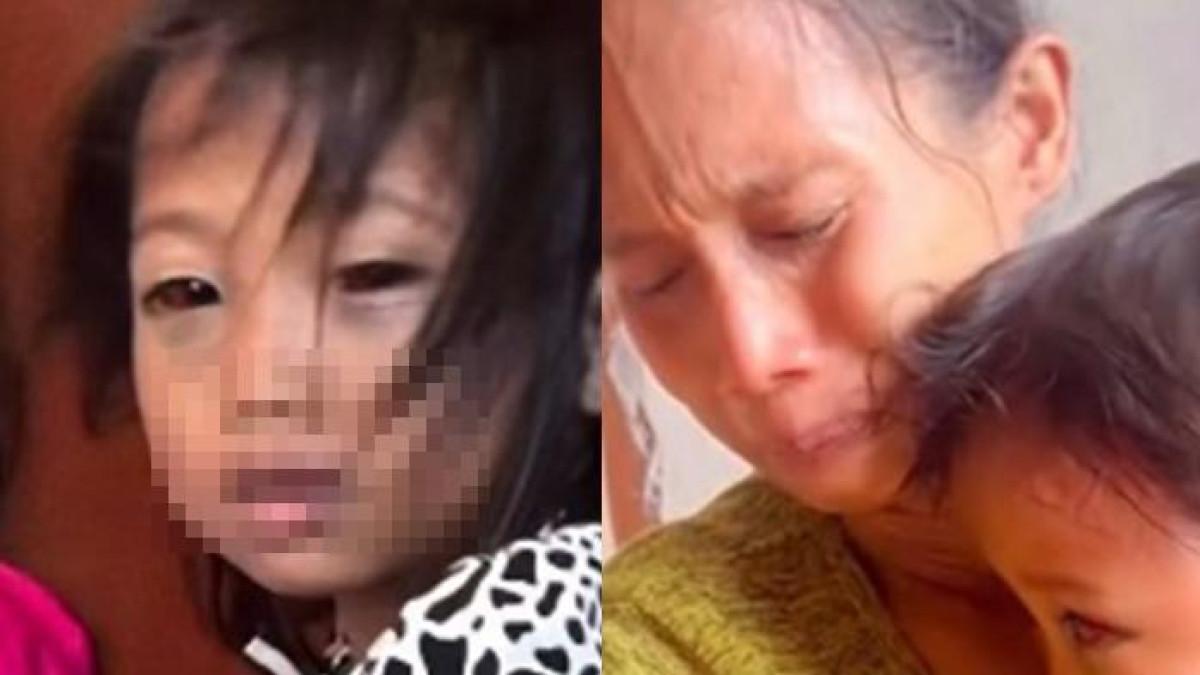 BOCAH MATA MERAH -- Kolase Instagram Oy Palembang. Heboh Bocah SD 150 Gandus Dua Matanya Merah dan Lebam saat Pulang Sekolah (Instagram)