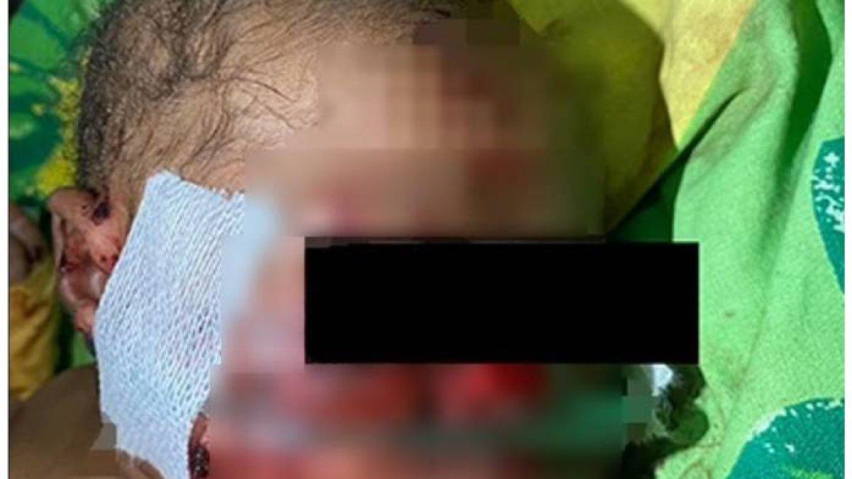 Dikubur Hidup-hidup Ibunya, Bayi Ini Ditemukan Masih Berpanas 6 Jam Kemudian, Masih Ada Tali Pusar