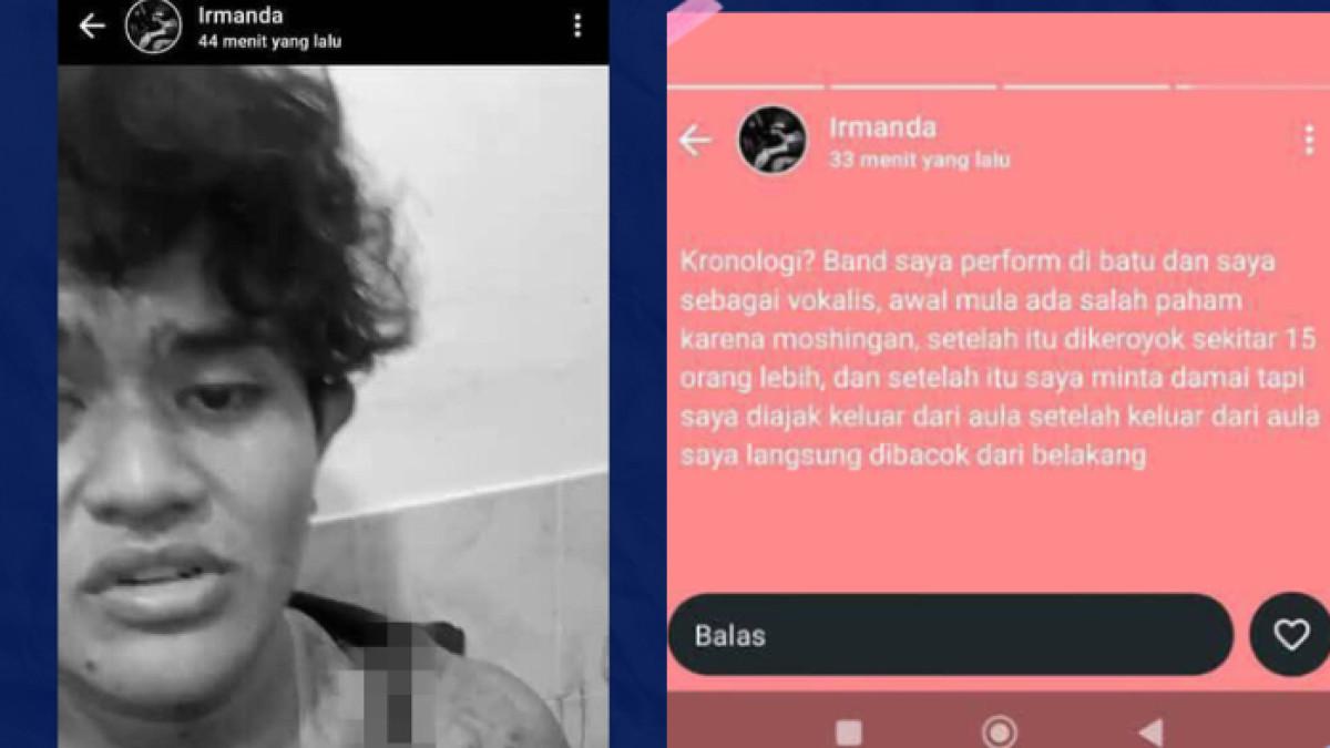 VOKALIS BAND DIKEROYOK - Inilah Irmanda, vokalis band asal Malang, Jawa Timur yang menjadi korban pengeroyokan. Pengeroyokan terjadi ketika Irmanda sedang tampil di Kota Batu.