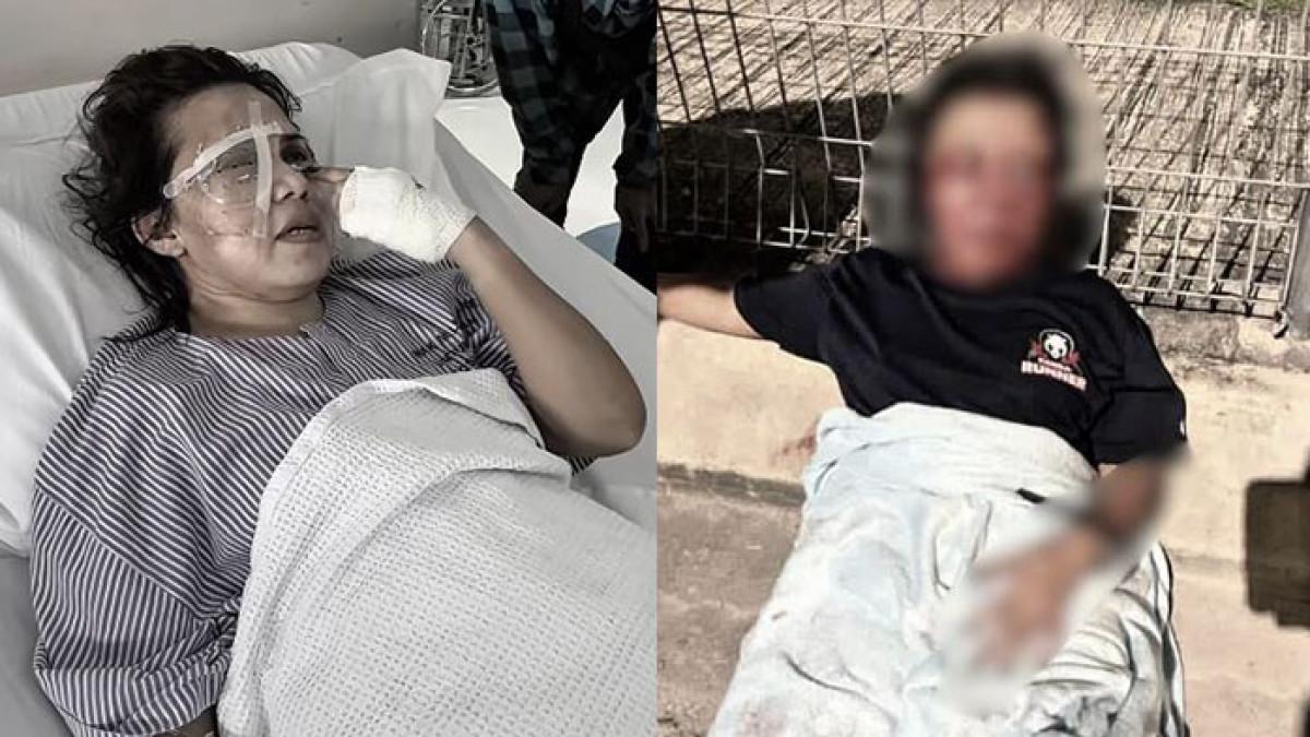 Kisah TKI Ayu Disiksa Majikan hingga Sekarat di Jalanan Malaysia, Mata Dicongkel & Kuping Digunting
