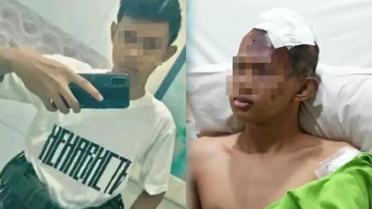 SOSOK VIRAL - Kondisi terkini terduga pelaku peledakan SMAN 72 Jakarta.