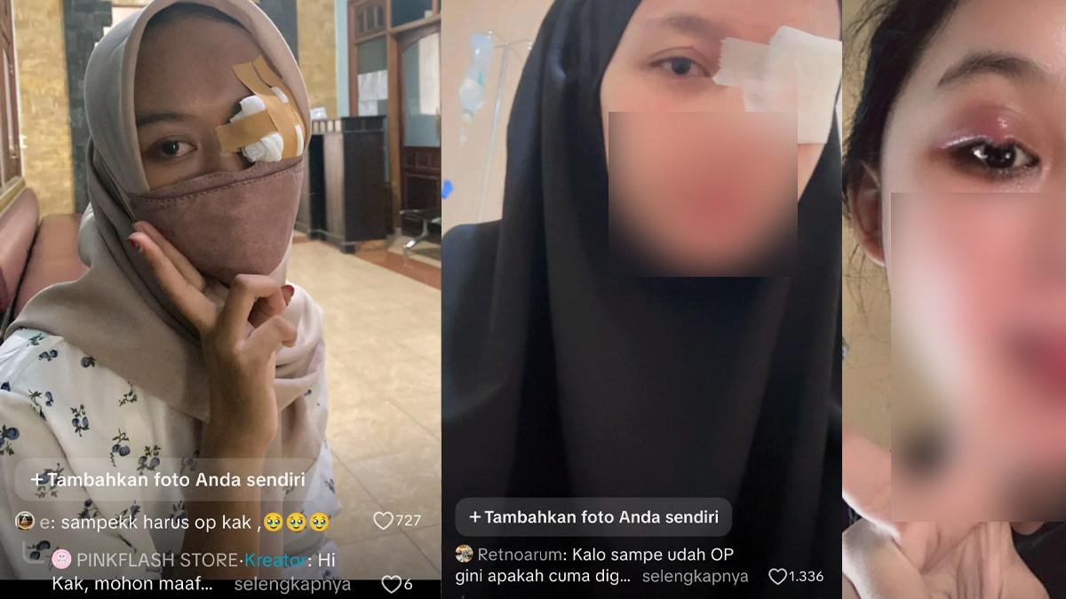 KORBAN EYESHADOW PINKFLASH - Deretan wanita yang mengalami iritasi mata hingga harus operasi plastik, mereka mengaku sakit setelah memakai eyeshadow PINKFLASH.