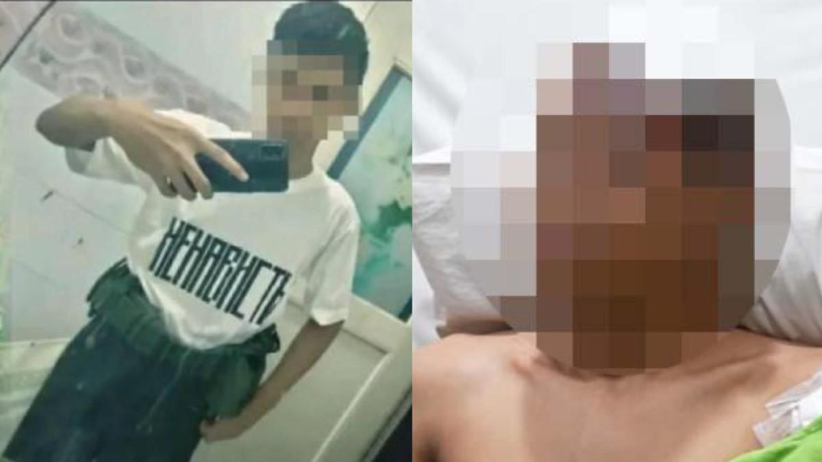 LEDAKAN DI SMAN 72 - Raut wajah terduga pelaku (kanan) ledakan di SMAN 72 Jakarta saat dijenguk Kapolri Jenderal Listyo Sigit Prabowo pada Sabtu, 8 November 2025