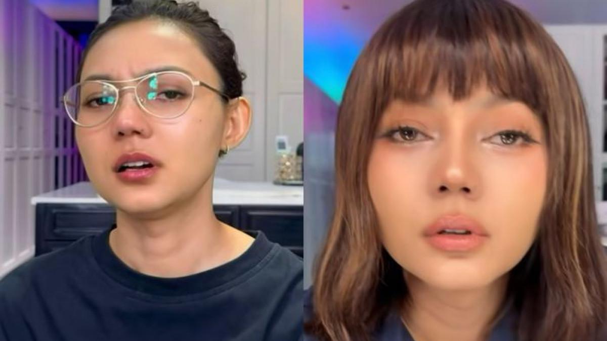 Rina Nose Bagikan Kabar Operasi Plastik yang Dilakukannya