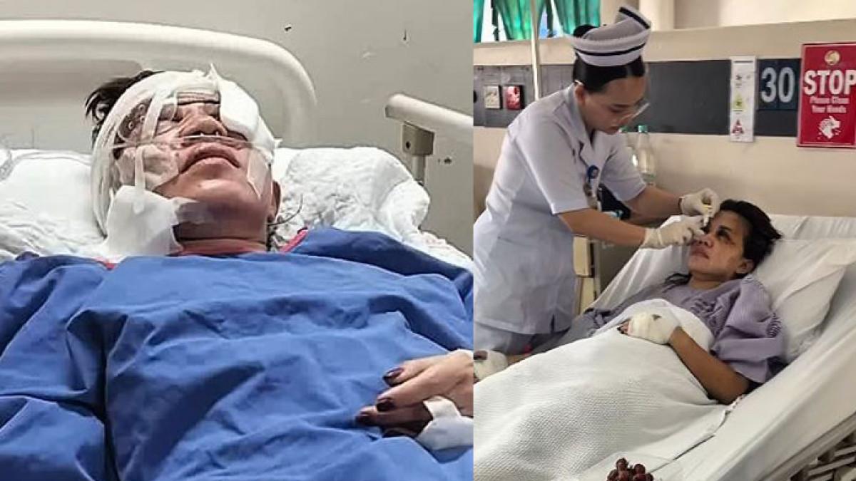 TKI DISIKSA MAJIKAN - Kondisi TKI Ayu saat dirawat di rumah sakit.