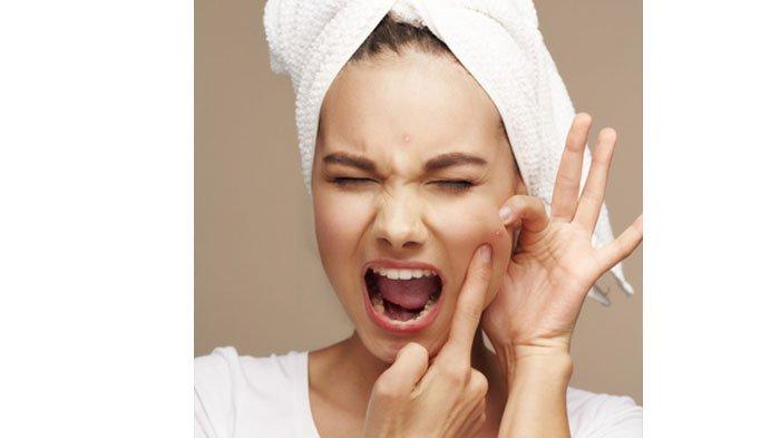 AWAS JANGAN Dipencet! Ini 10 Cara Alami Hilangkan Jerawat, Pakai Cuka Apel hingga Masker Putih Telur